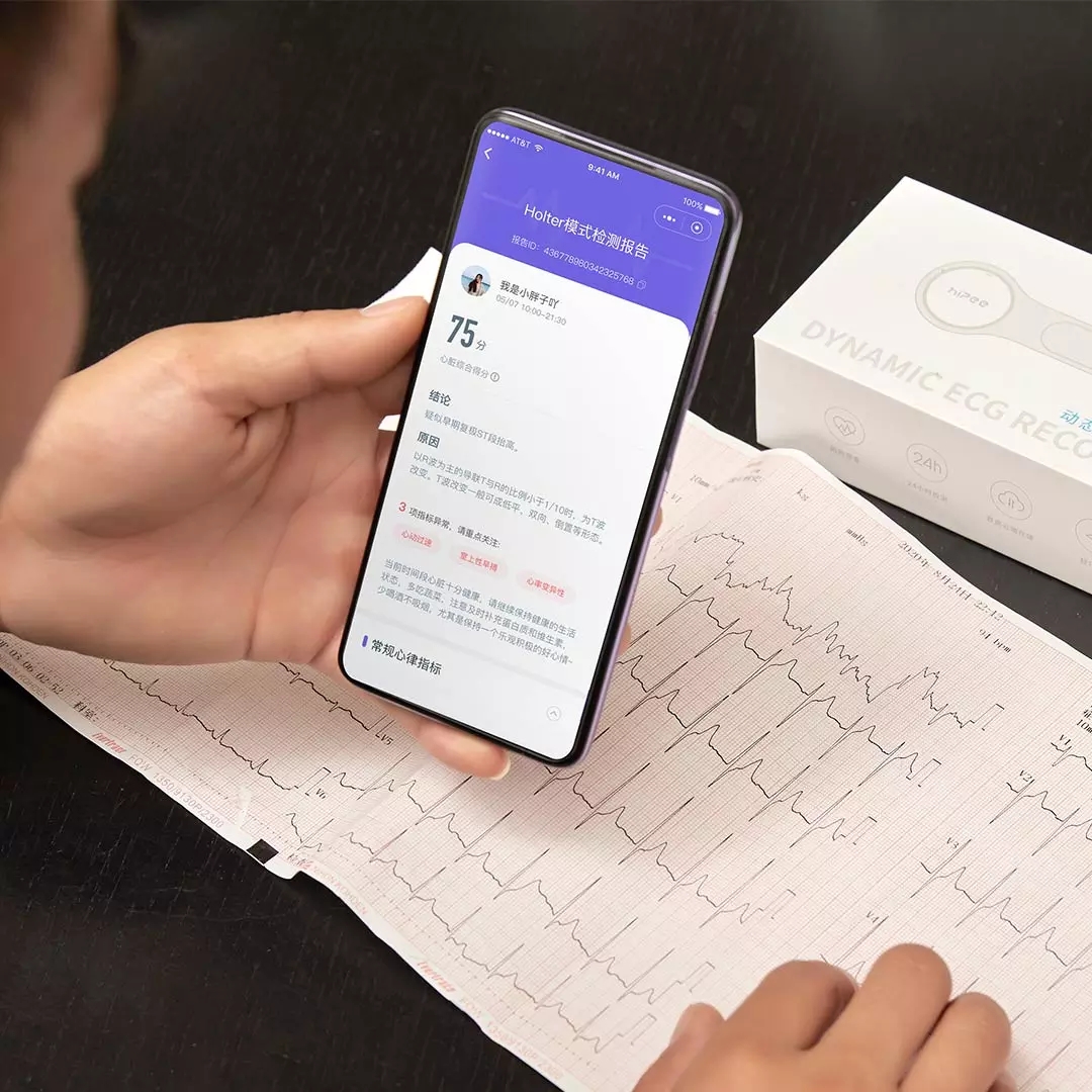 Xiaomi HiPee Dynamic ECG Recorder